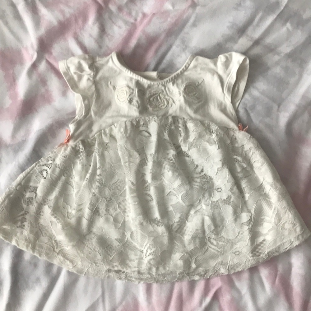 Lace Dress